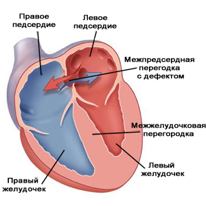 Лента для установки окон Меленковский район